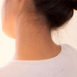 Боли в шее у ребенка — причины и лечение