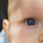 Врожденная катаракта у ребенка