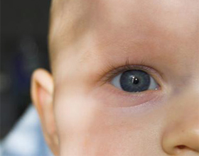 Врожденная катаракта у ребенка
