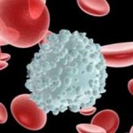 Повышенный уровень лимфоцитов в крови у ребенка: причины и что делать